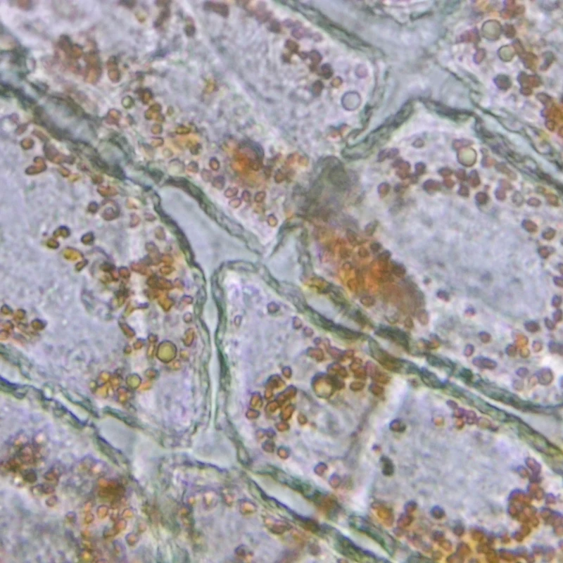 Leaf Cross Section I